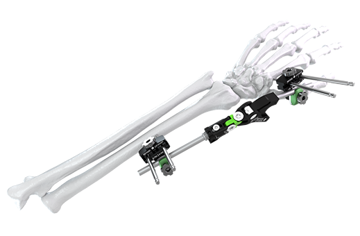 Galaxy wrist frame Galaxy wrist frame